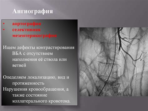 Тромбоз мезентериальных сосудов - презентация онлайн