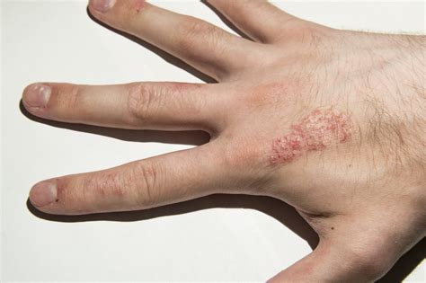I have a skin disease, but no idea what it is? - Ask a doctor free ...