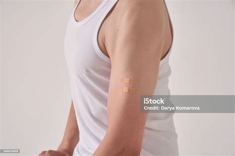 A Scar From The Calmetteguerin Bacillus Bcg Or Antituberculosis Vaccine ...