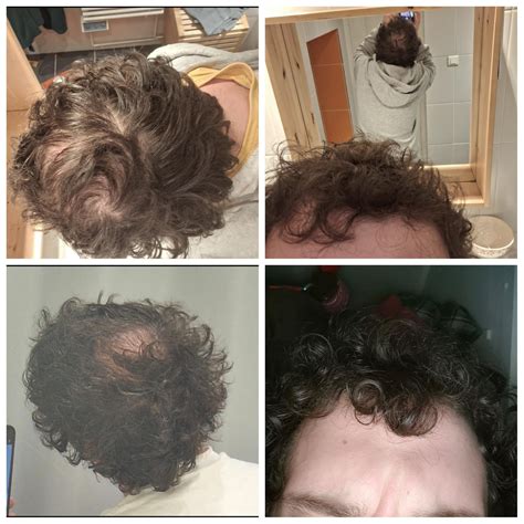 A complete guide on how to get a bald fade 6