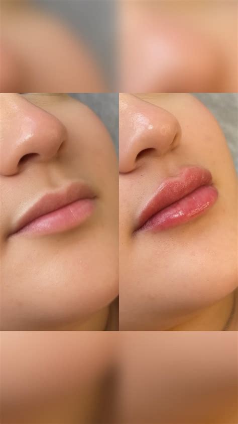 Ivette | Brows | Tooth Gems | Lip Filler | Los Angeles (@prettybynature