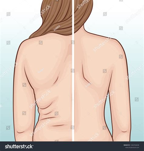 32,814 Back Fat Images, Stock Photos & Vectors | Shutterstock