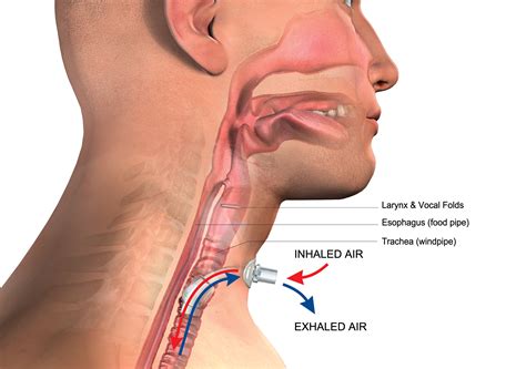 Esophagus And Trachea