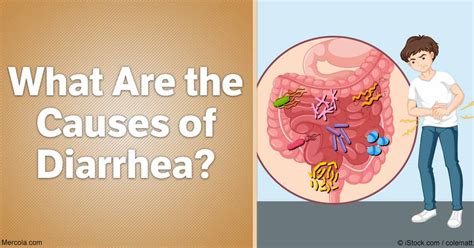 What Are the Causes of Diarrhea?