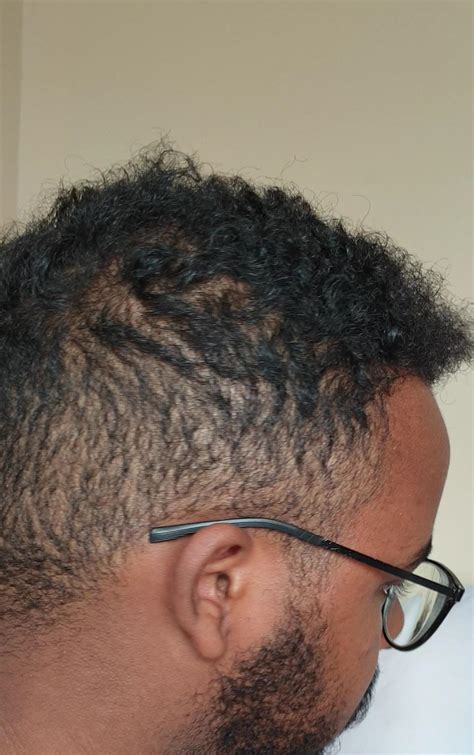Quite A Head Of Hair 10