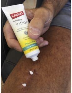 how long to take aspirin after knee replacement