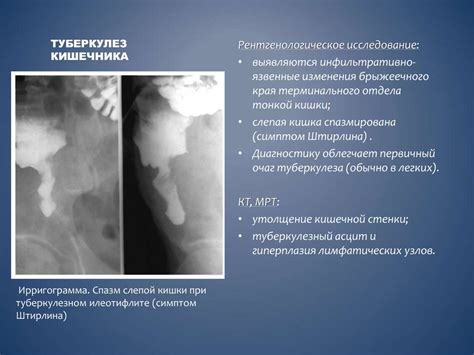 Лучевое исследование кишечника - презентация онлайн