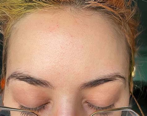 [skin concerns] these odd red pinprick looking dots are all over my