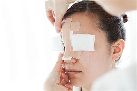 Royalty Free Nose Bandage Pictures, Images and Stock Photos - iStock