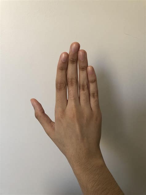 Why are my fingers like this? They are all a bit crooked : r/Anatomy