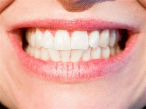 xpx   hd wallpaper persons teeth dentist
