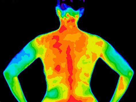 Duodenitis: What Is Duodenitis?