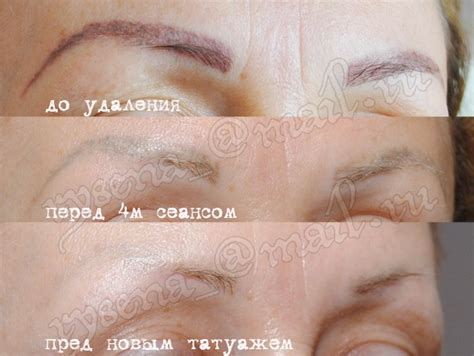 Брови После Татуажа Растут - serezhki-dlja-brovi39