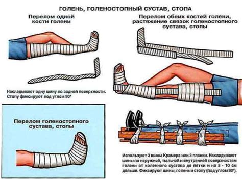 Оказание первой помощи пострадавшим на производстве - презентация онлайн