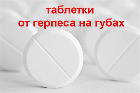 Таблетки при герпесе на губах | Вирус Герпес