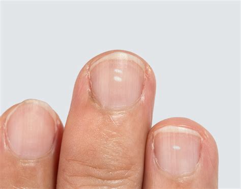 What Do White Spots On Your Fingernails Mean? - Organic Olivia
