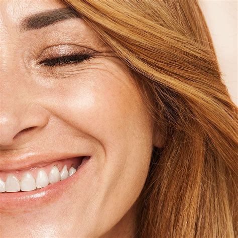 Deep Smile Lines: Fix Them Without Looking Overdone