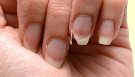 Unhas Fracas O Que Pode Ser - Unhas fracas pode ser sinal de problemas de saúde - Alegrete Tudo