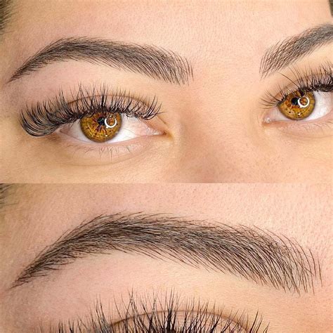 cejas  rejuvenece peru centro de medicina estetica  cirugia plastica