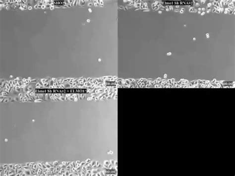 De-repression of the RAC activator ELMO1 in cancer stem cells drives ... 