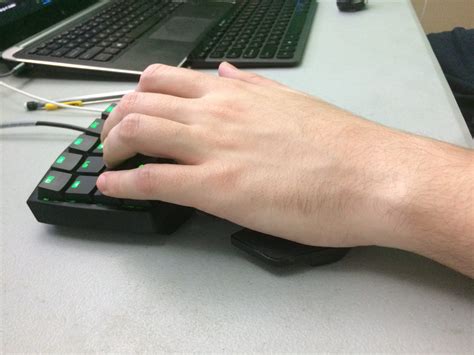 How to Approach Knuckle Pain in Gaming | Based off a FAQ