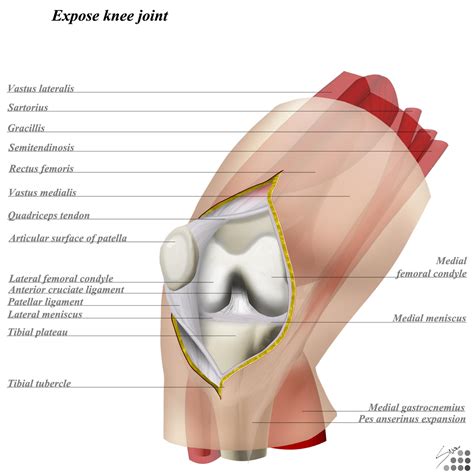 Knee Posterior Approach Approaches Orthobullets