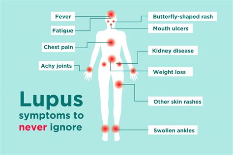Lupus Symptoms Lupus And Your Skin: Signs And Symptoms