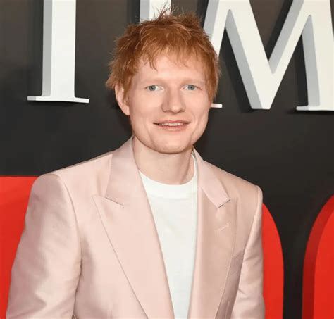 ed sheeranin yillar icindeki yeni dis donusumu lema dental clinic