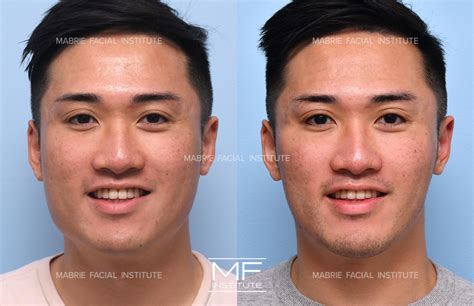 Wearing braids with bangs has a surprising face slimming effect 17