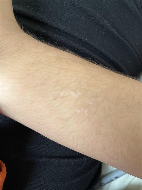 What do you think this is from! : r/scars