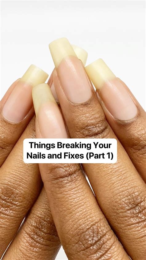 How to stop nail breakage – Artofit