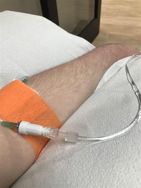 First remicade infusion!! : r/UlcerativeColitis