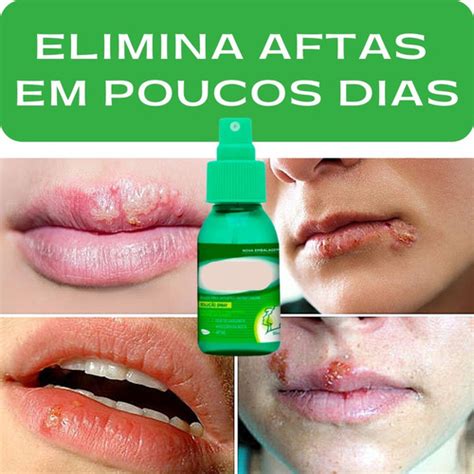 O Que E Bom Pra Afita