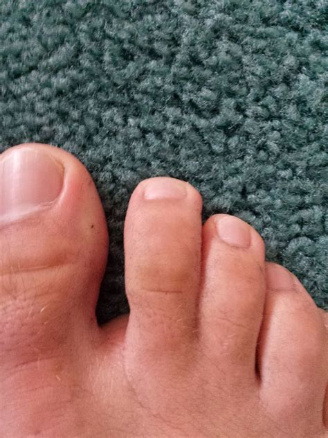 Two of my toes are webbed and come out of the same joint. : r