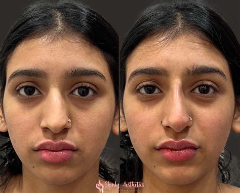 Trey Gowdy's Nose: The Before & After Photos You Won't Believe! Image 18