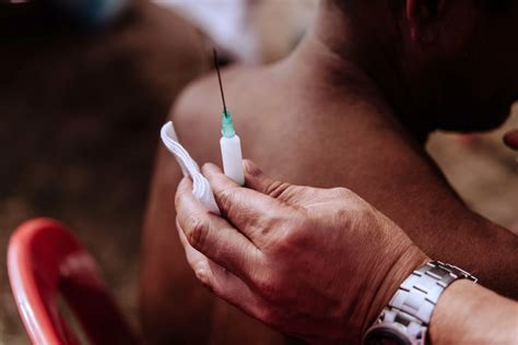 joint injection   cpd  experience levels