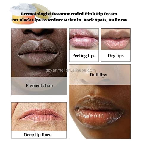 dermatologist  dark lips  daryl hudson blog