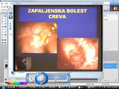 Video predavanja - Gastroenterologija