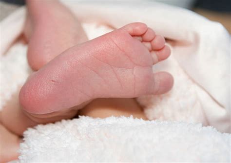 Phenylketonuria Stock Photos, Pictures & Royalty-Free Images - iStock