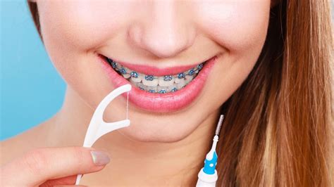 Fio Dental Para Aparelho