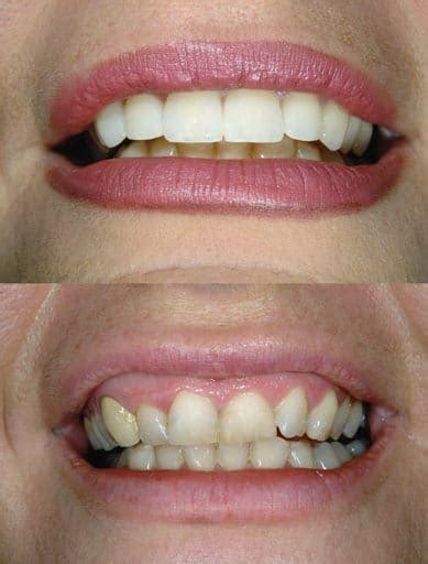 Smile Revival: 5 Proven Ways To Transform Your Teeth And Boost Your Confidence