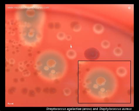 streptococcus agalactiae  staphylococcus aureus comparison growth