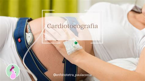 Cardiotocografia A Partir De Quantas Semanas - "Cardiotocografia: O Exame Essencial para Monitorar a Saúde do Bebê a ...