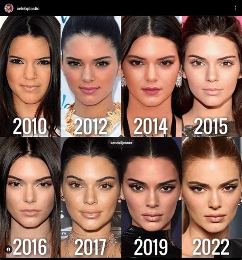 Rate Kendall Jenner before and after plastic surgery : r/VindictaRateCelebs