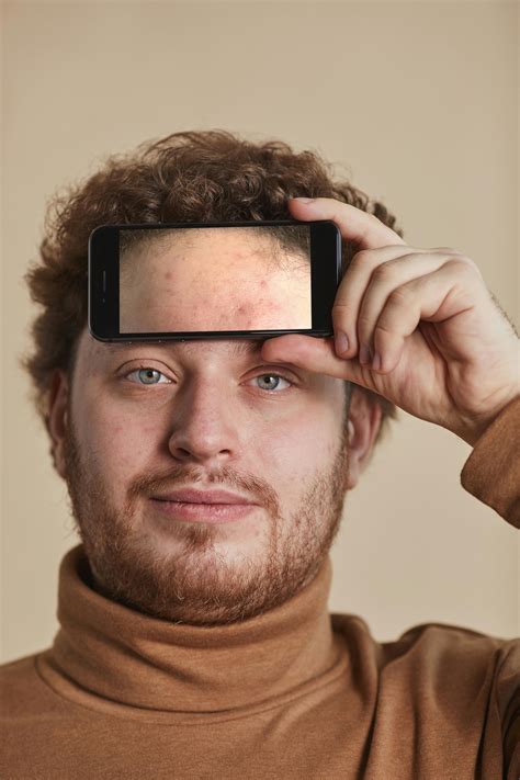 Forehead Acne Photos, Download The BEST Free Forehead Acne Stock Photos