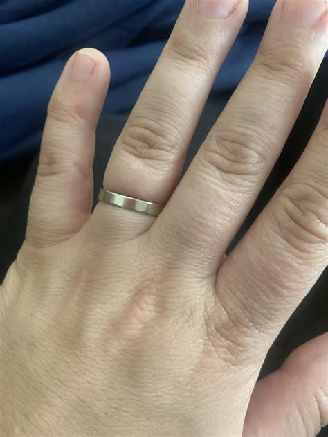 Acrogeria? I’m a 32 year old female. Do my hands look “older “? I go to ...