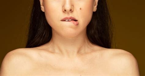 Bride Demands Bridesmaid Get 'Distracting' Mole Removed