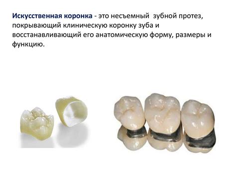 Искусственные коронки. Штампованная и цельнолитая металлические коронки ...