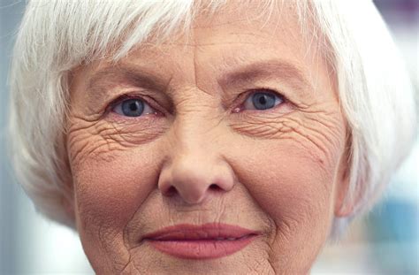 Ramsay Hunt Syndrome: What are the effects on your eyes and how should