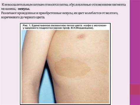 Морфологические элементы сыпи - презентация онлайн